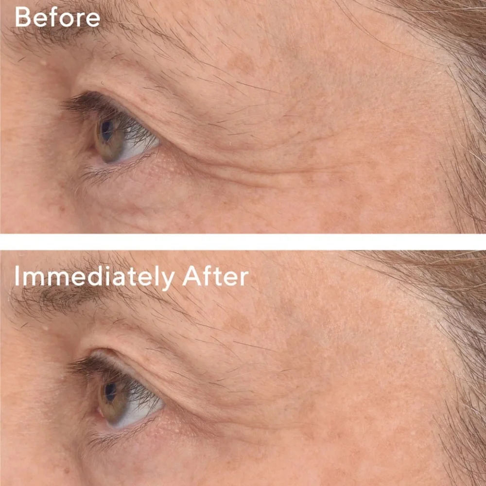 Murad Retinol Youth Renewal Eye Masks